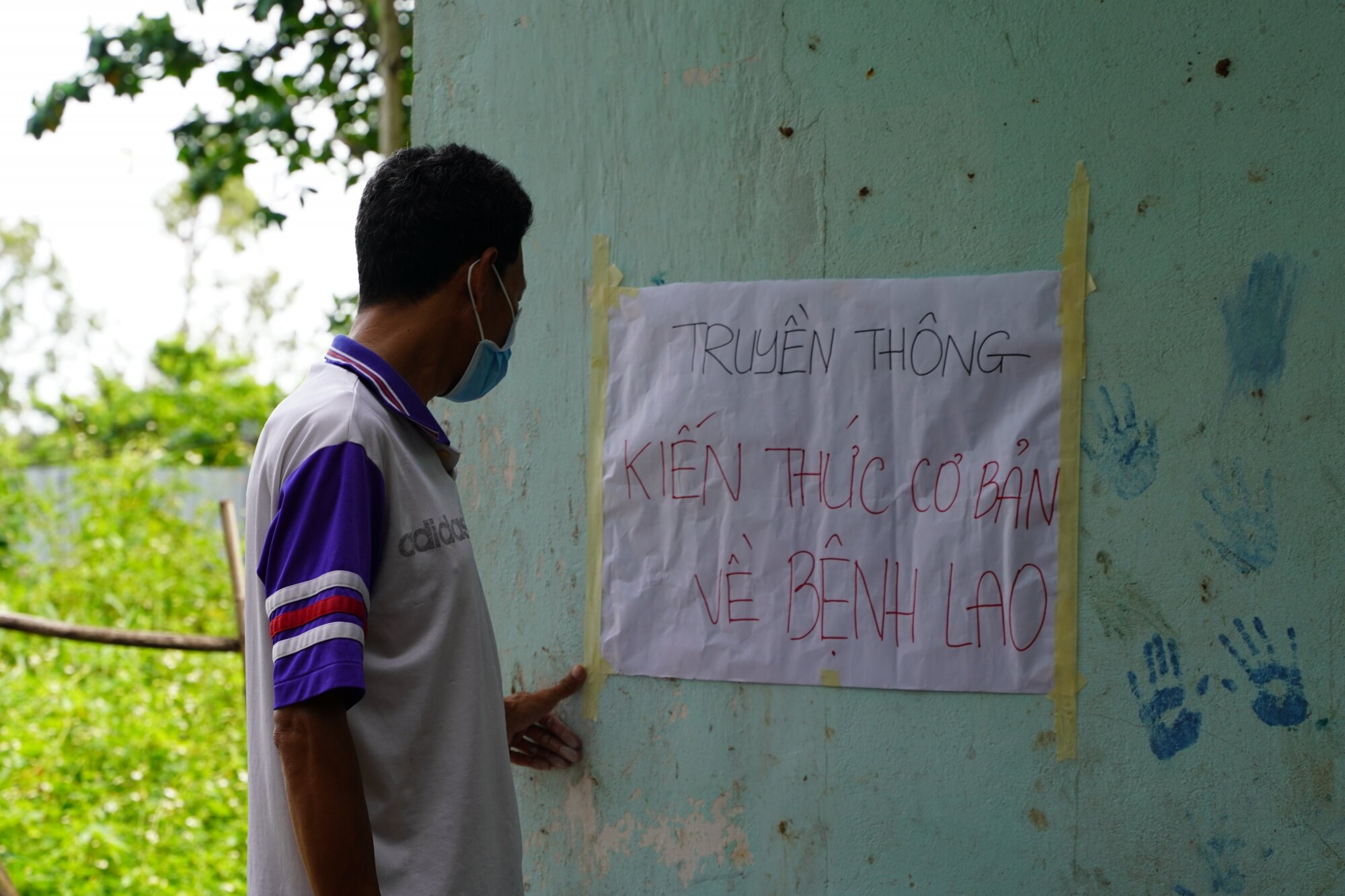 CSET mở rộng tiếp cận, bao phủ khoảng trống trong chăm sóc và phòng chống lao